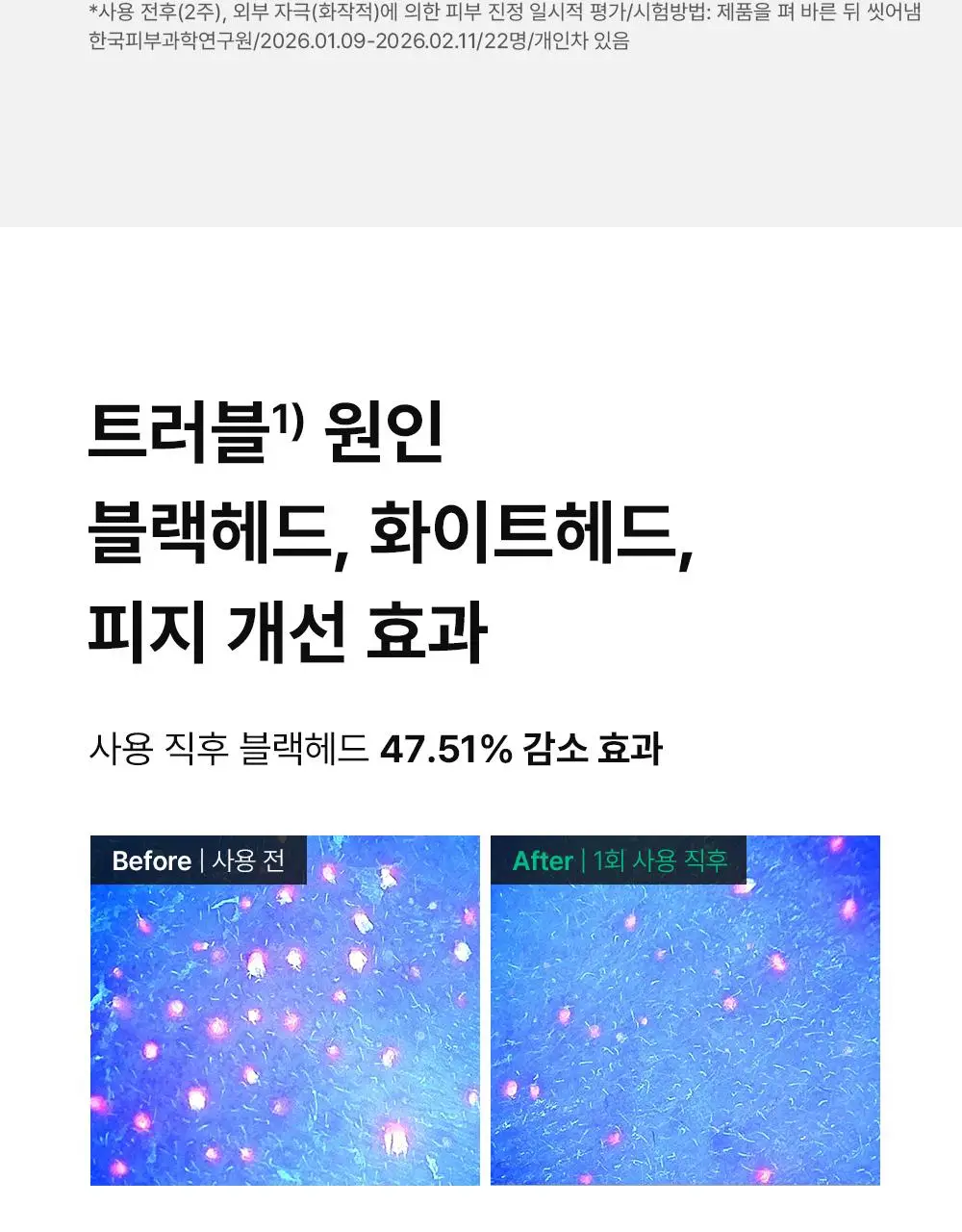 [단독기획] 동아제약 아크네 프로 겔제 30ml 기획(+3ml+크림제3ml) 상세페이지 12
